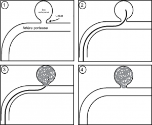 Schema coiling simple